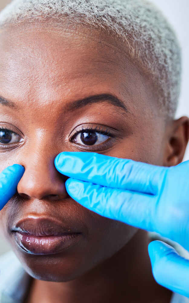 Rhinoplasty (nose job)