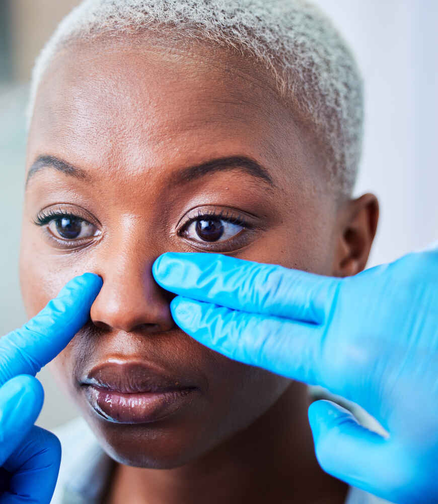 Rhinoplasty (nose job)