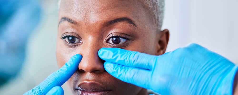 Rhinoplasty (nose job)